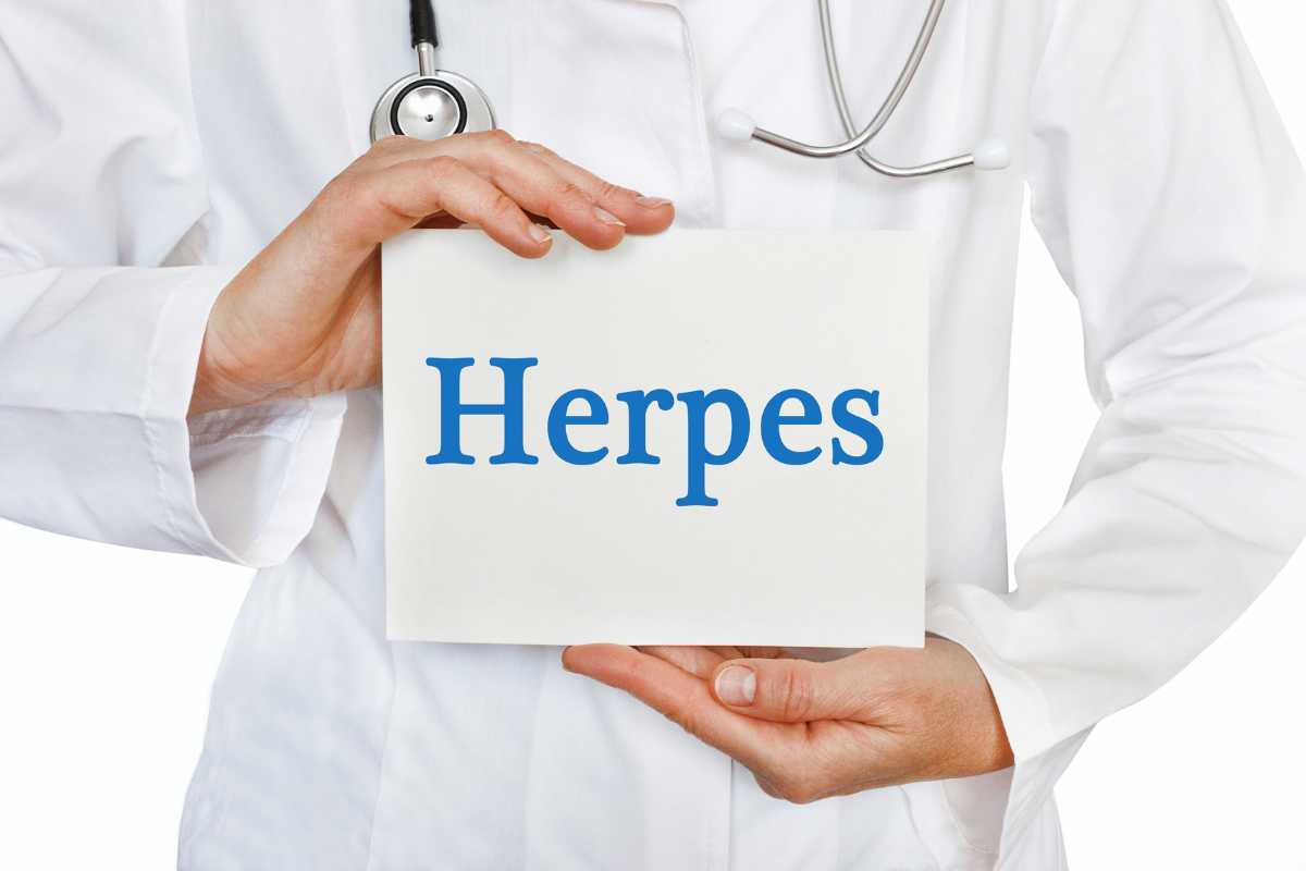 Virus herpes